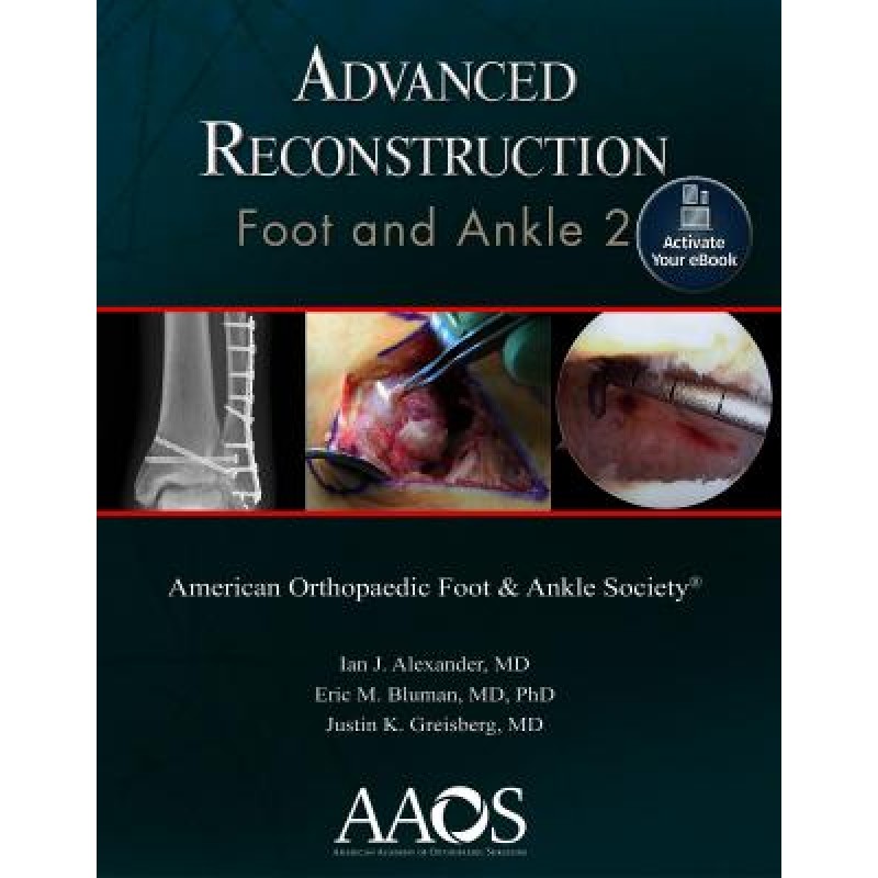 Advanced Reconstruction: Foot and Ankle 2
