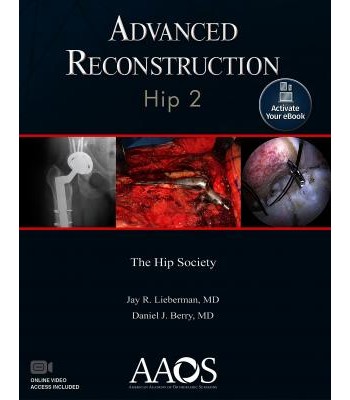 Advanced Reconstruction: Hip 2