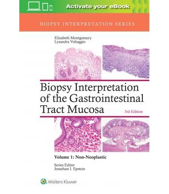 Biopsy Interpretation of the Gastrointestinal Tract Mucosa: Volume 1: Non-Neoplastic, 3e