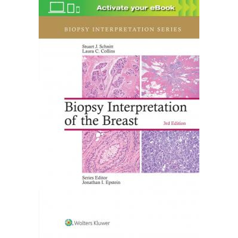 Biopsy Interpretation of the Breast, 3e
