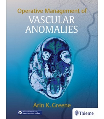Operative Management of Vascular Anomalies