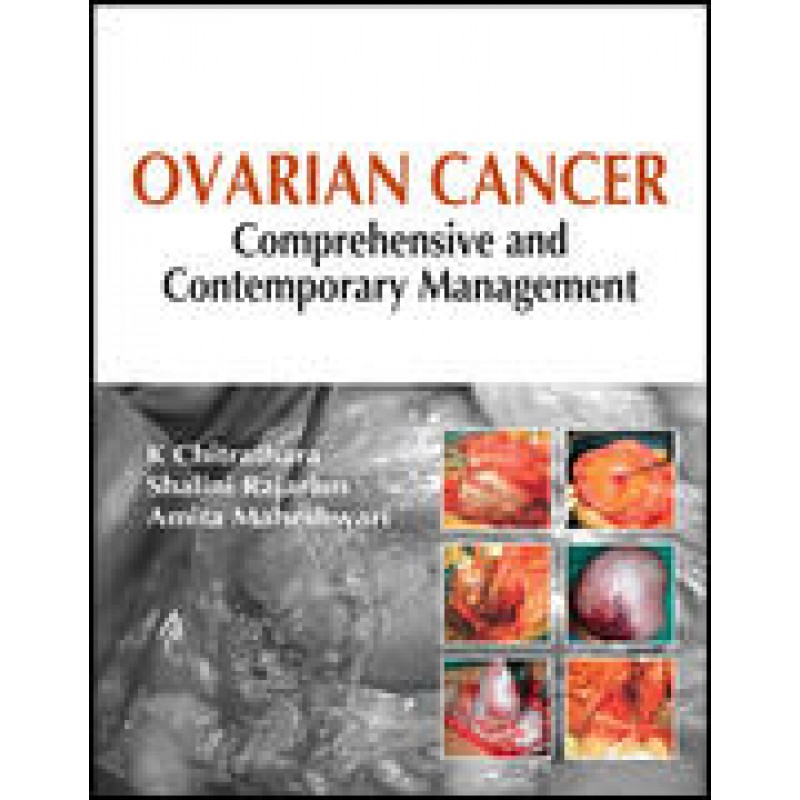 Ovarian Cancer: Comprehensive and Contemporary Management