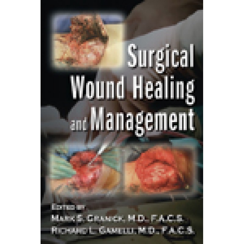 Surgical Wound Healing and Management