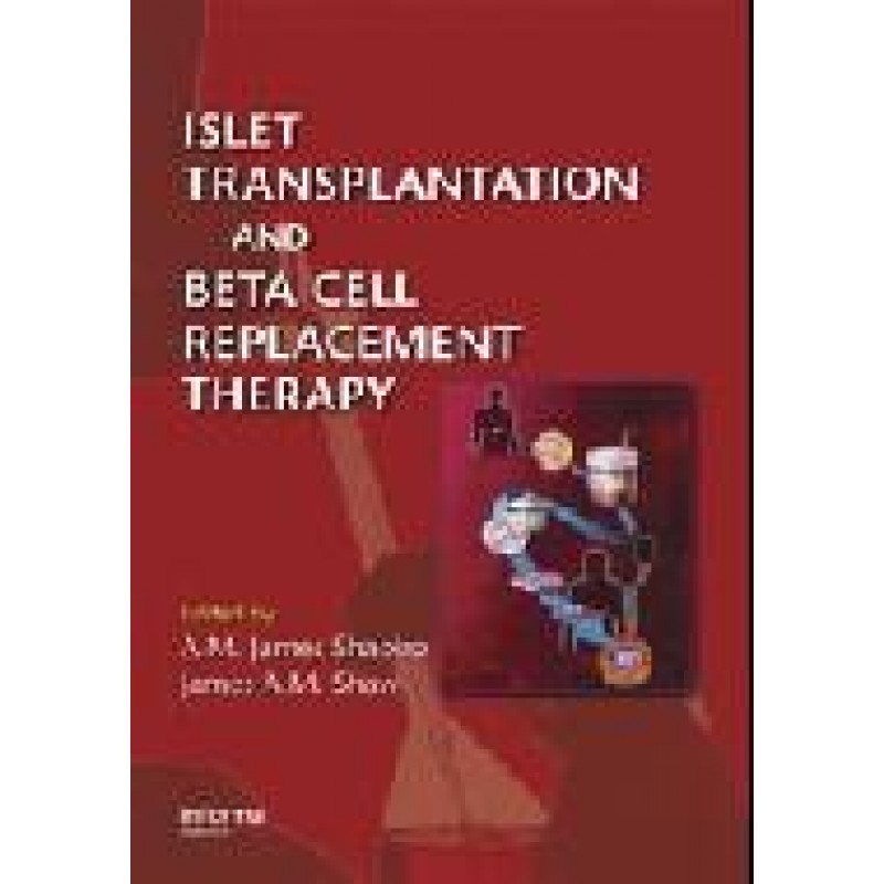 Islet Transplantation and Beta Cell Replacement Therapy