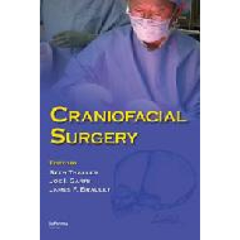 Craniofacial Surgery