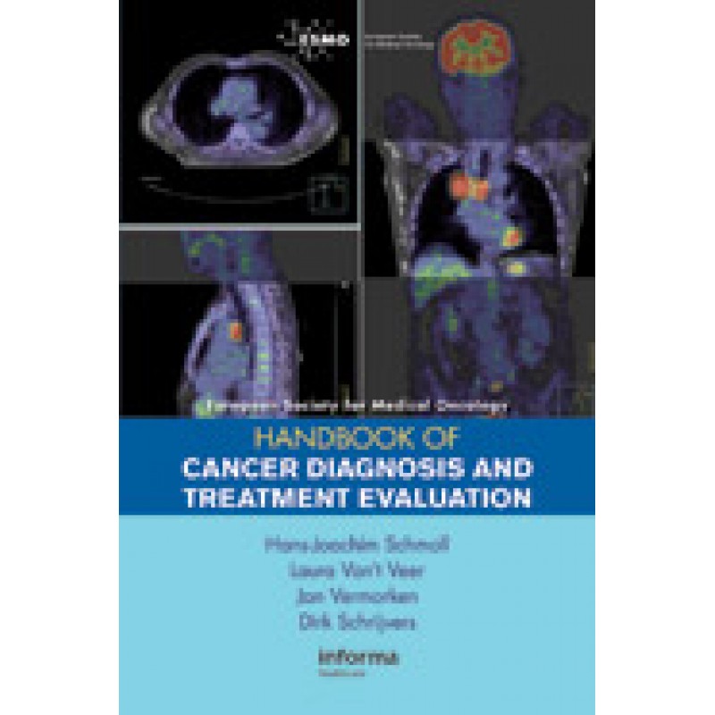 ESMO Handbook of Cancer Diagnosis and Treatment Evaluation