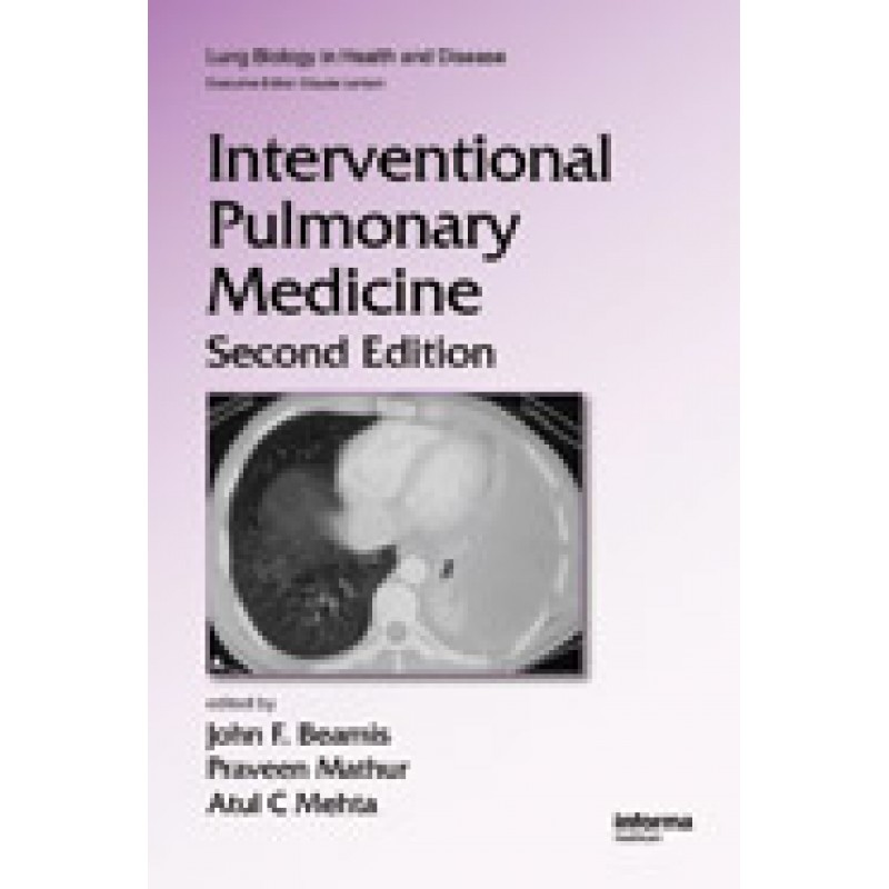Interventional Pulmonary Medicine, Second Edition Series: Lung Biology in Health and Disease