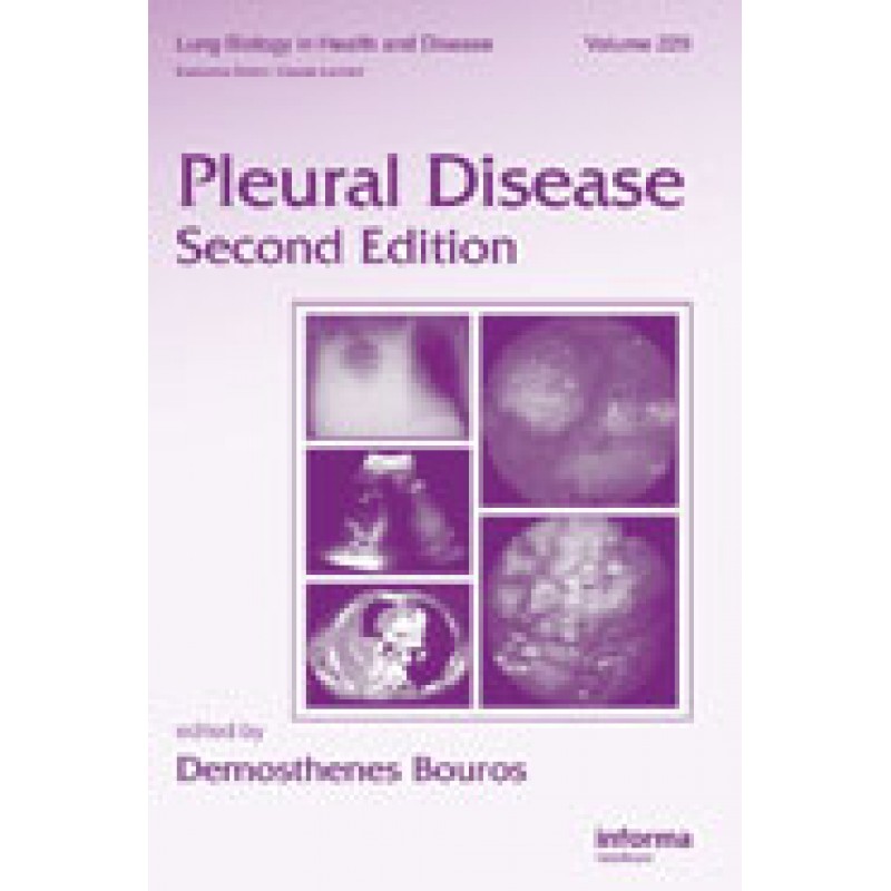 Pleural Disease, Second Edition  Series: Lung Biology in Heath and Disease