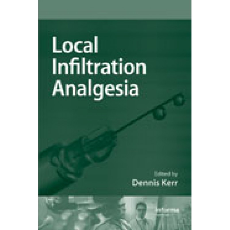 Local Infiltration Analgesia