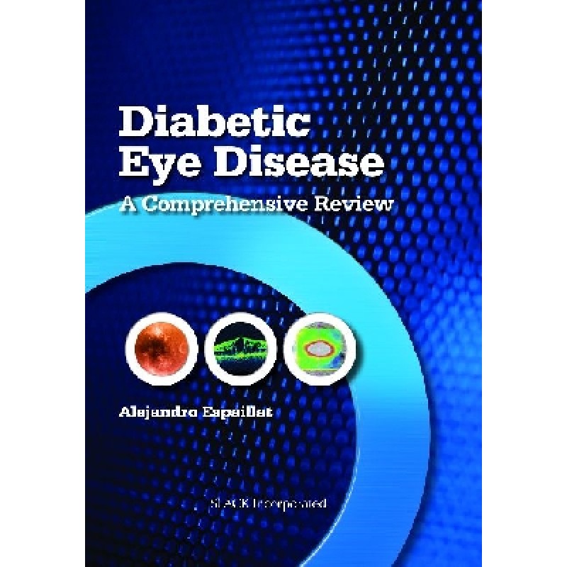 Diabetic Eye Disease