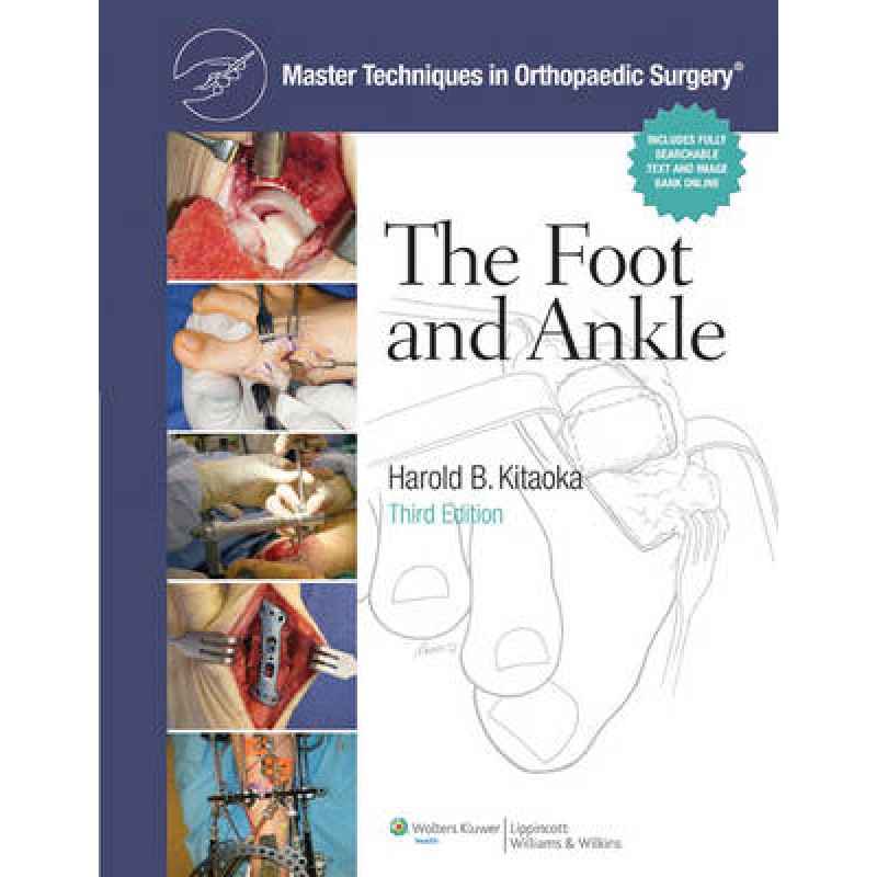 Master Techniques in Orthopaedic Surgery: Foot and Ankle , 3rd Edition