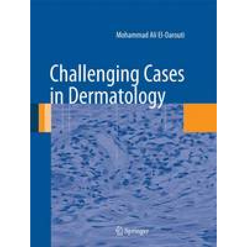 Challenging Cases in Dermatology