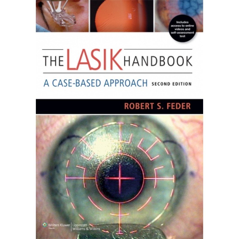 The LASIK Handbook, Second Edition
