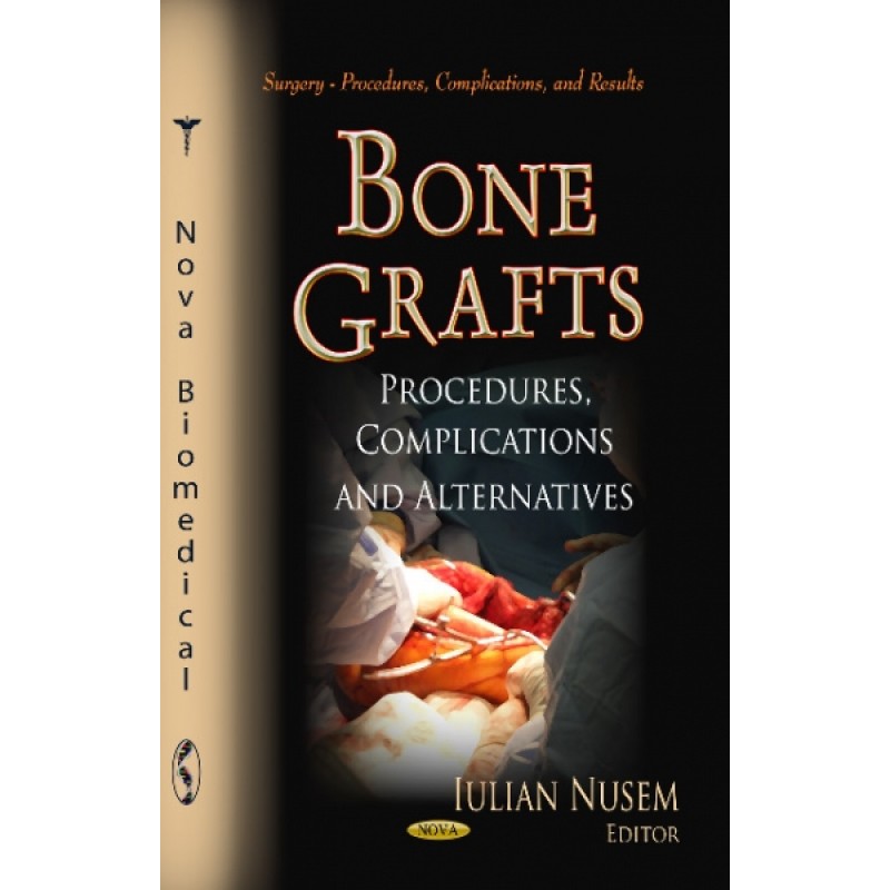 Bone Grafts