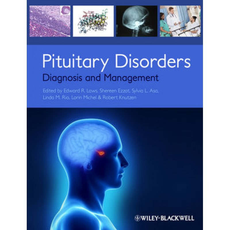 Pituitary Disorders: Diagnosis and Management