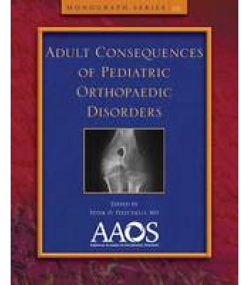 Adult Consequences of Pediatric Orthopaedic Disorders