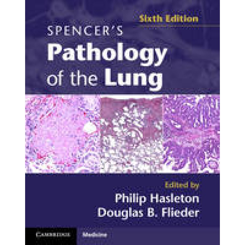 Spencer's Pathology of the Lung 2 Part Set, 6th Revised edition