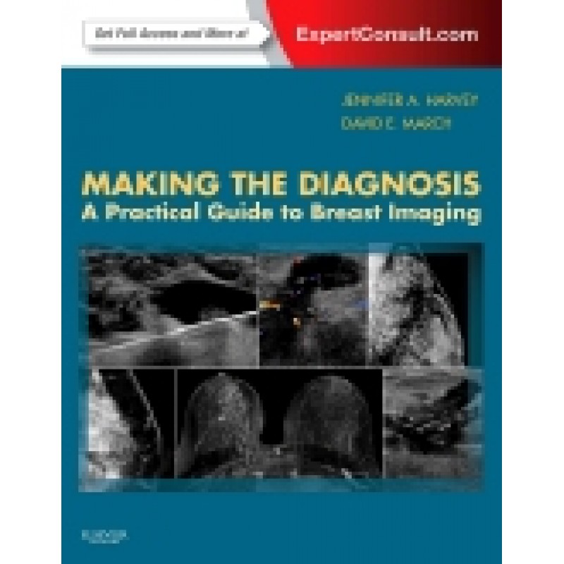 Making the Diagnosis: A Practical Guide to Breast Imaging