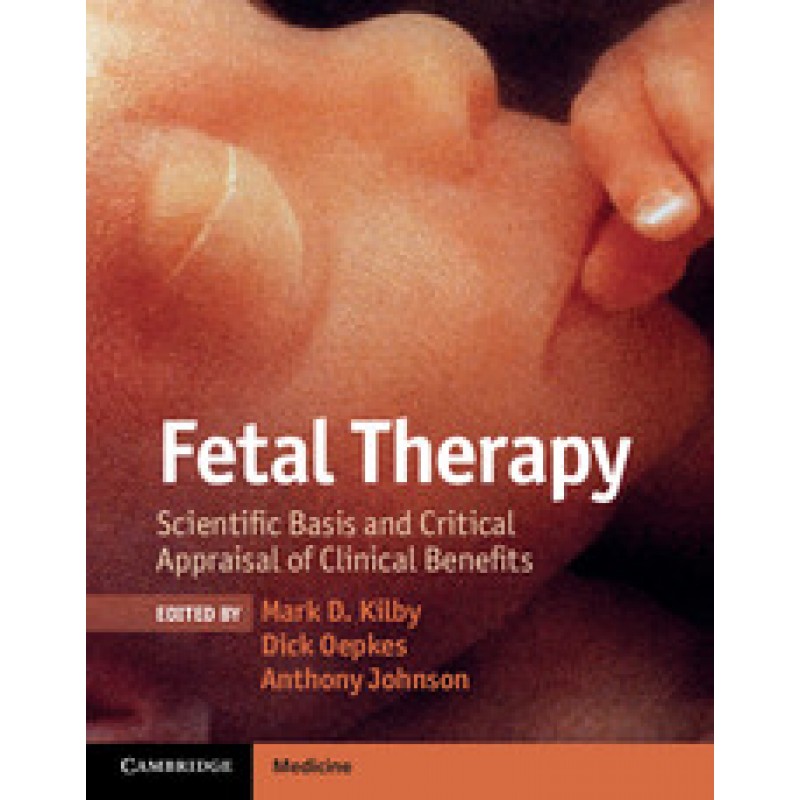 Fetal Therapy