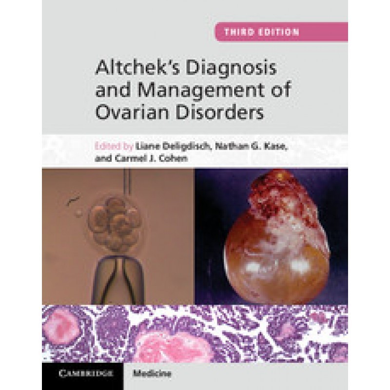 Altchek's Diagnosis and Management of Ovarian Disorders, 3rd Edition