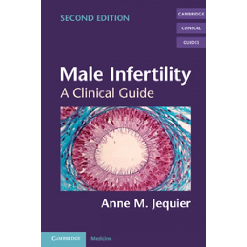 Male Infertility, 2nd Edition