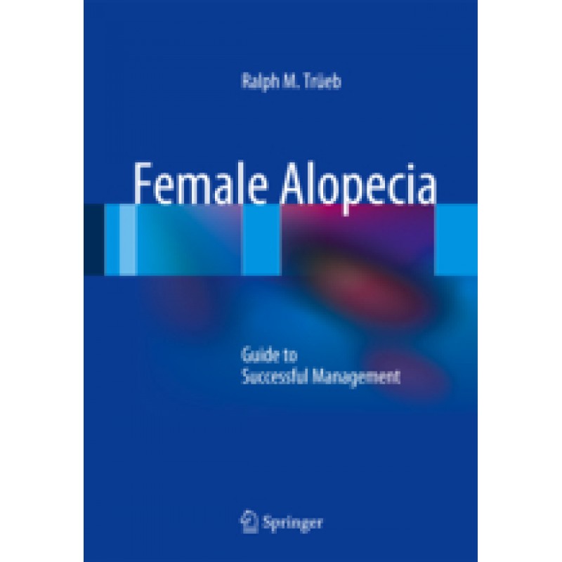 Female Alopecia