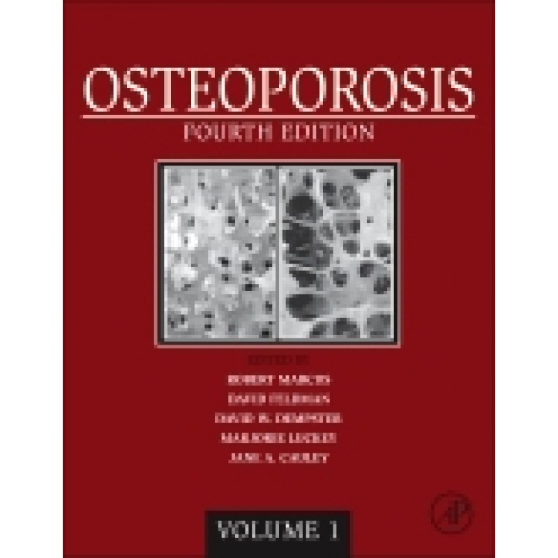 Osteoporosis, 4th Edition