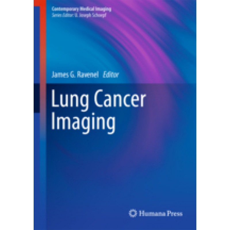 Lung Cancer Imaging