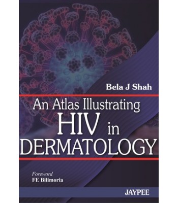An Atlas Illustrating HIV in Dermatology