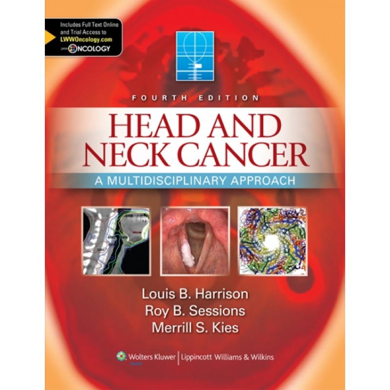 Head and Neck Cancer, 4e