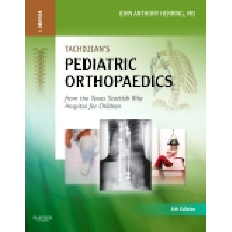 Tachdjian's Pediatric Orthopaedics: From the Texas Scottish Rite Hospital for Children, 5th Edition