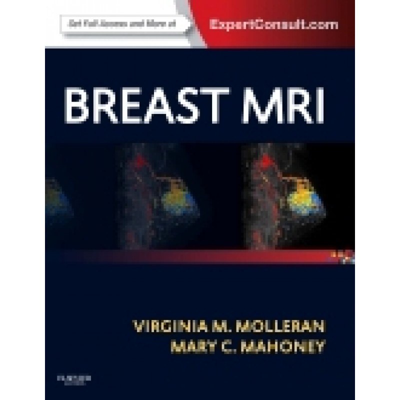 Breast MRI