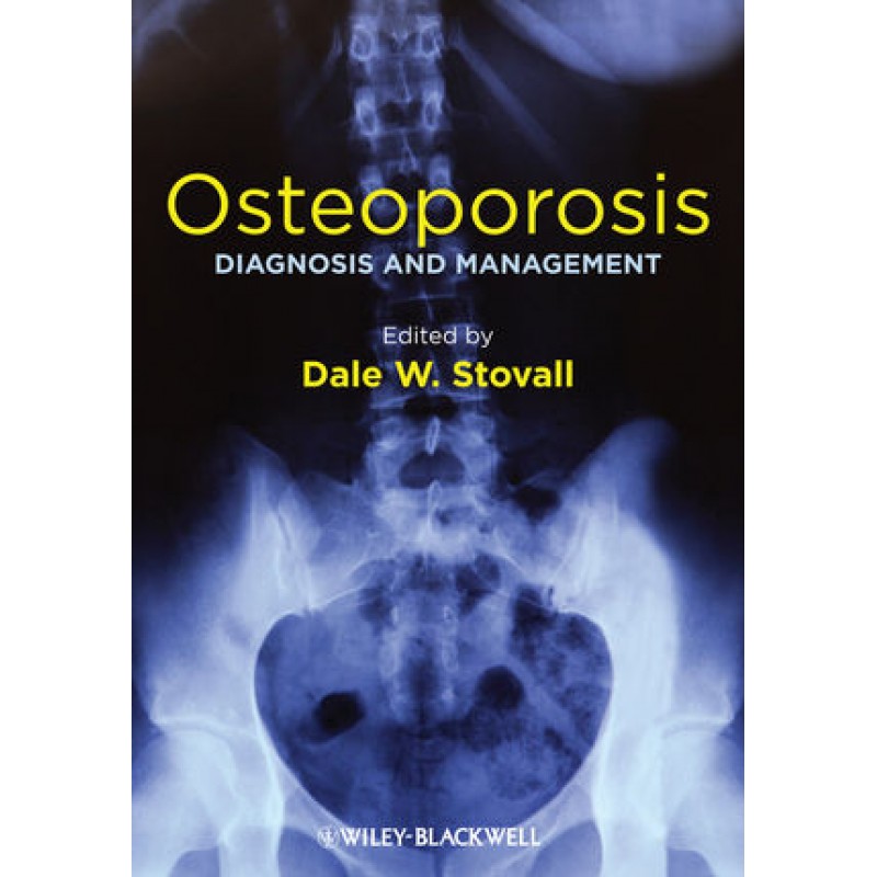 Osteoporosis: Diagnosis and Management