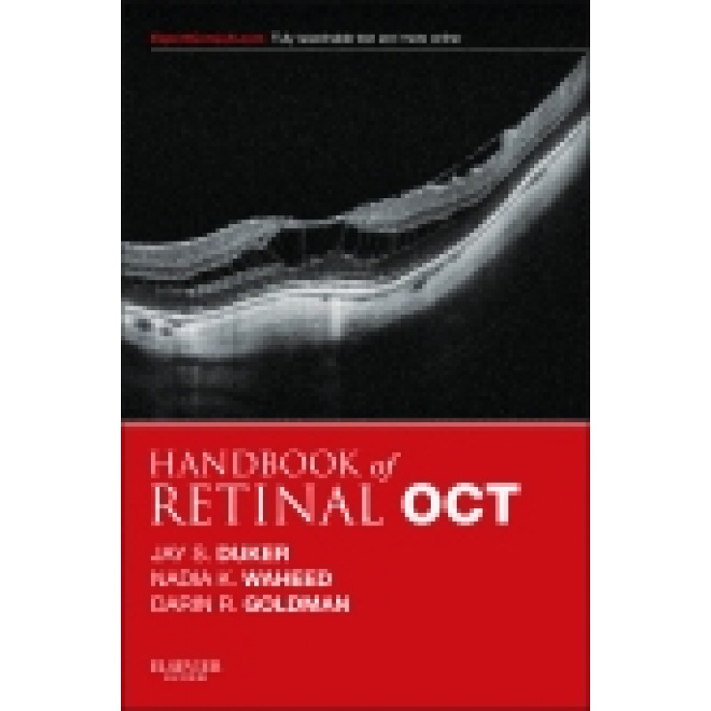 Handbook of Retinal OCT: Optical Coherence Tomography
