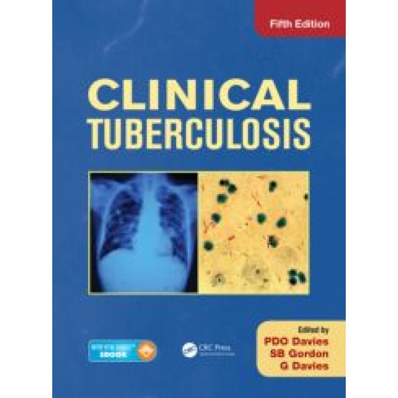 Clinical Tuberculosis, Fifth Edition 2014