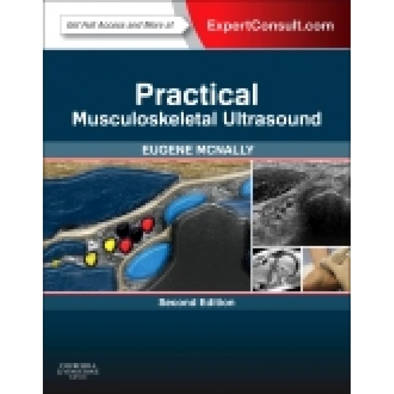 Practical Musculoskeletal Ultrasound, Expert Consult:Online and Print, 2nd Edition
