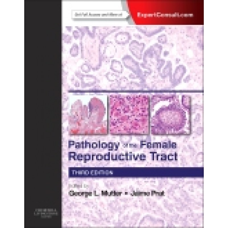Pathology of the Female Reproductive Tract, Expert Consult: Online and Print, 3rd Edition