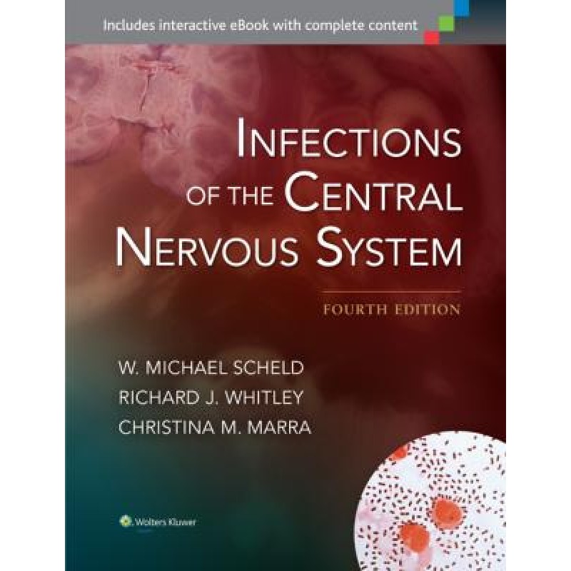 Infections of the Central Nervous System, 4e