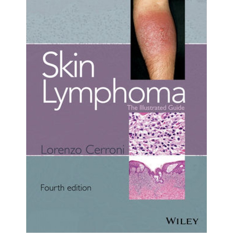 Skin Lymphoma: The Illustrated Guide, 4th Edition
