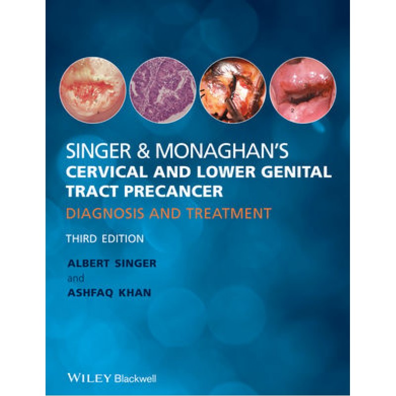 Singer  and Monaghan's Cervical and Lower Genital Tract Precancer: Diagnosis and Treatment, 3rd Edition