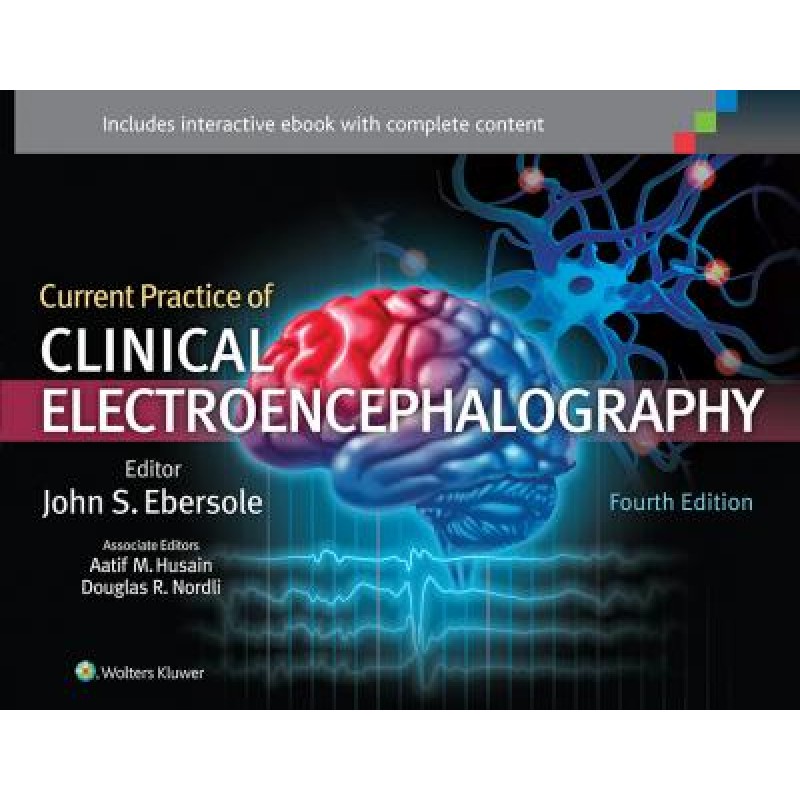 Current Practice of Clinical Electroencephalography, 4e