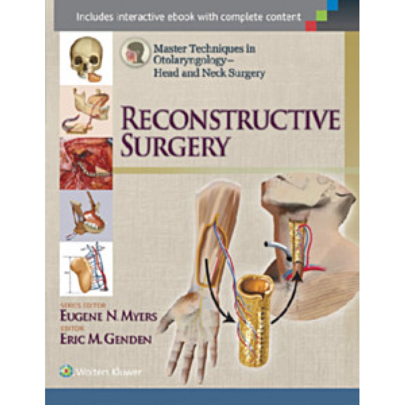 Master Techniques in Otolaryngology - Head and Neck Surgery: Reconstructive Surgery