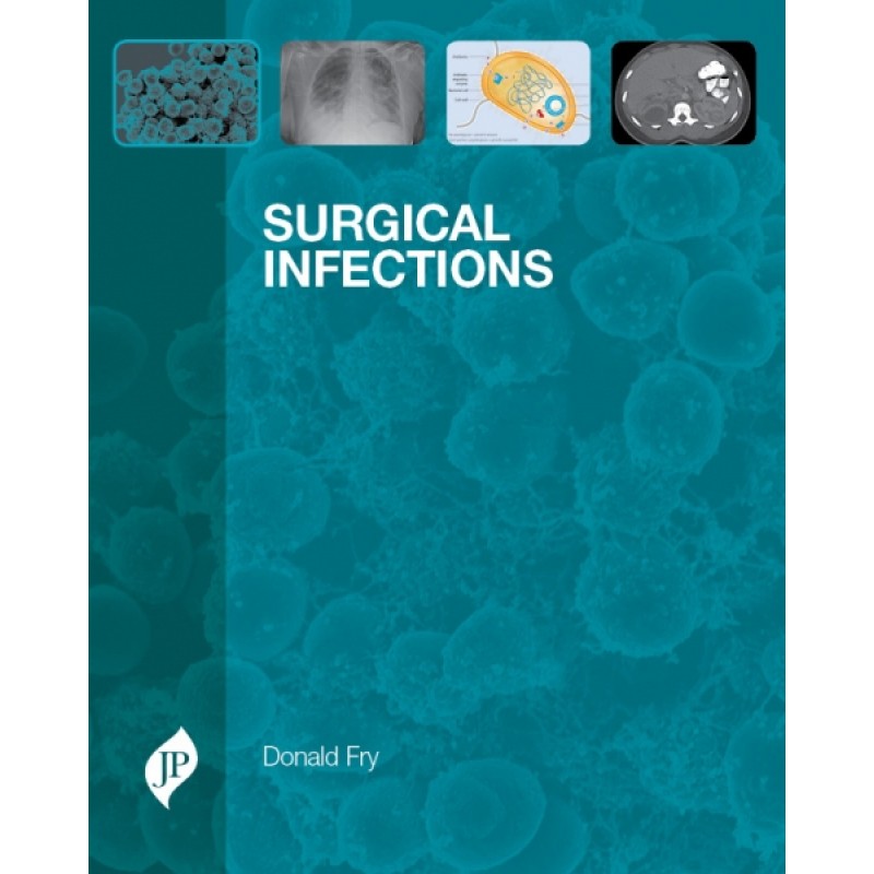 Surgical Infections