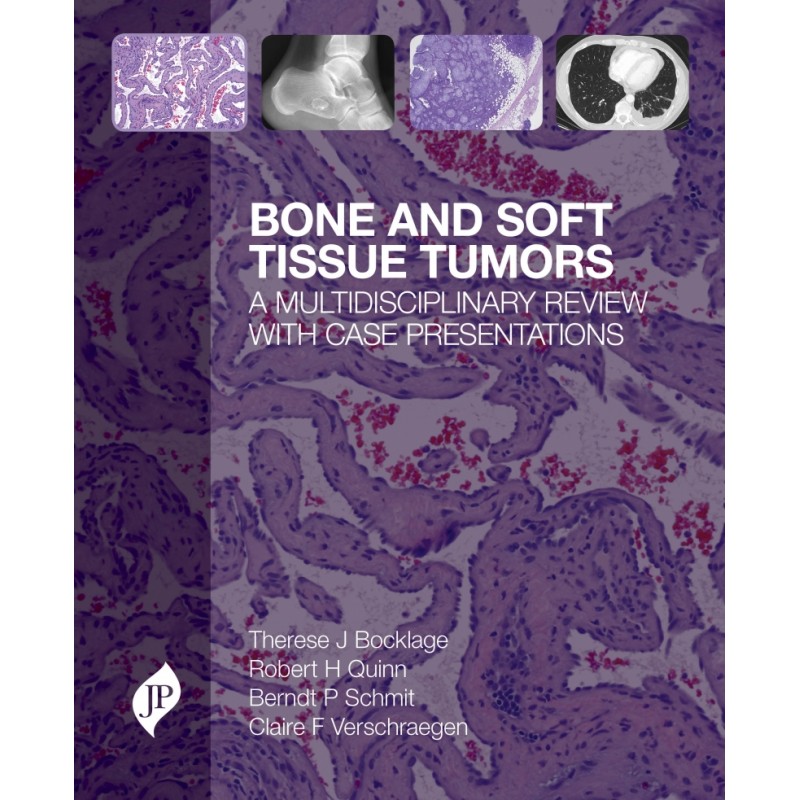 Bone and Soft Tissue Tumors