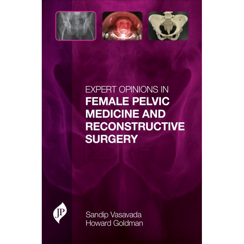 Expert Opinions in Female Pelvic Medicine and Reconstructive Surgery