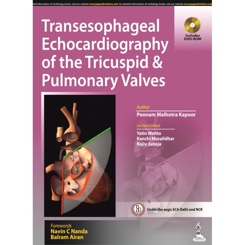 Transesophageal Echocardiography of the Tricuspid  and  Pulmonary Valves