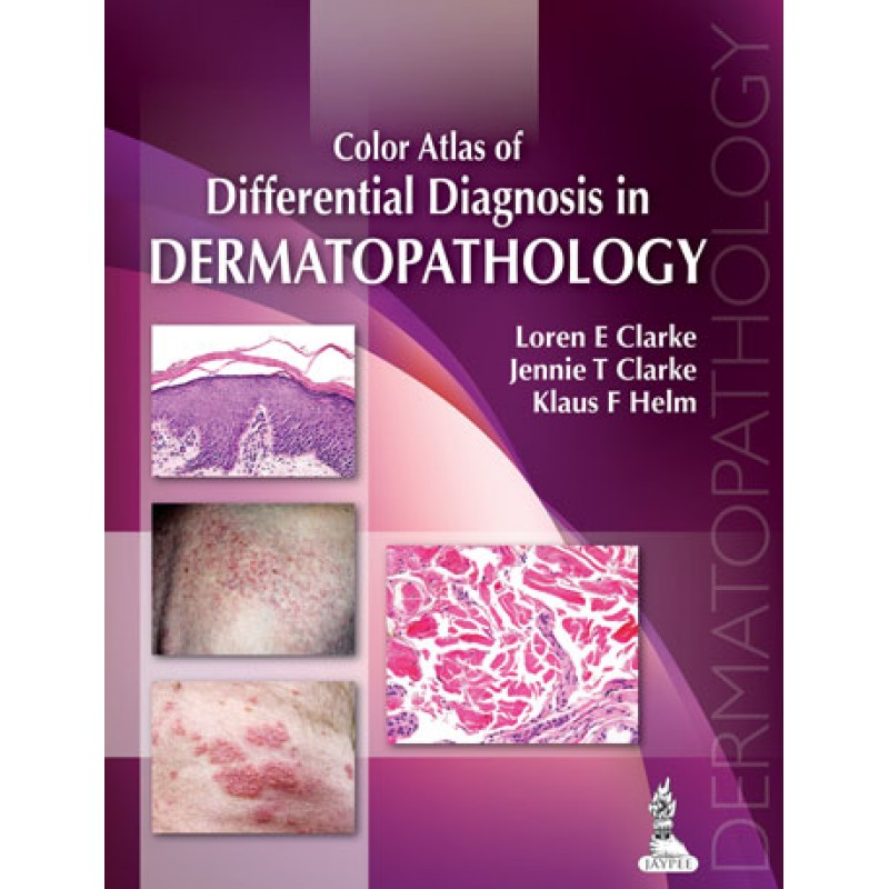 Color Atlas of Differential Diagnosis in Dermatopathology