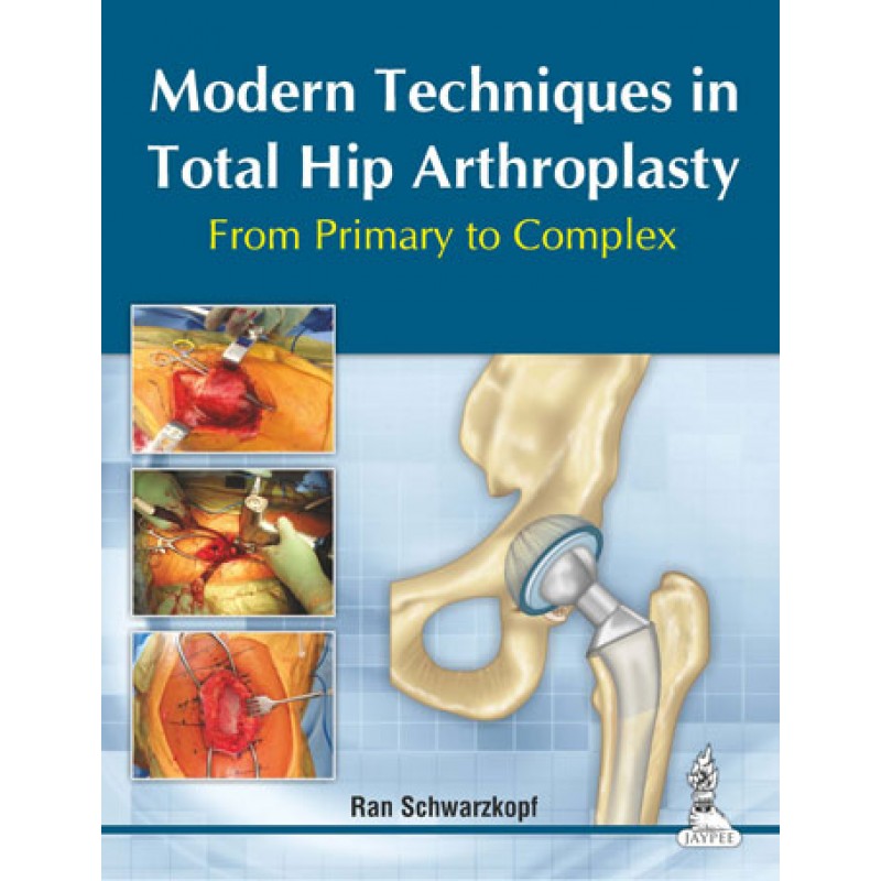 Modern Techniques in Total Hip Arthroplasty