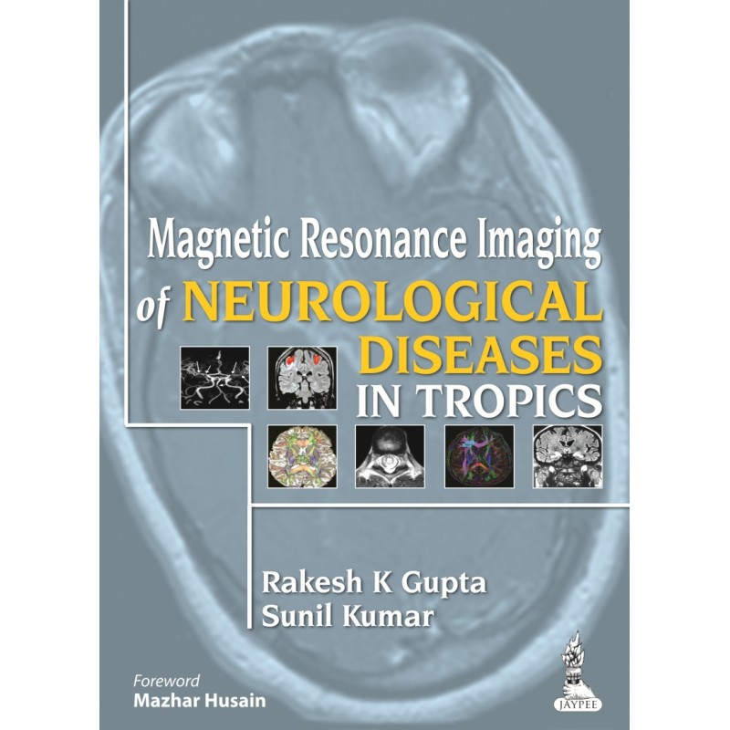 Magnetic Resonance Imaging of Neurological Diseases in Tropics