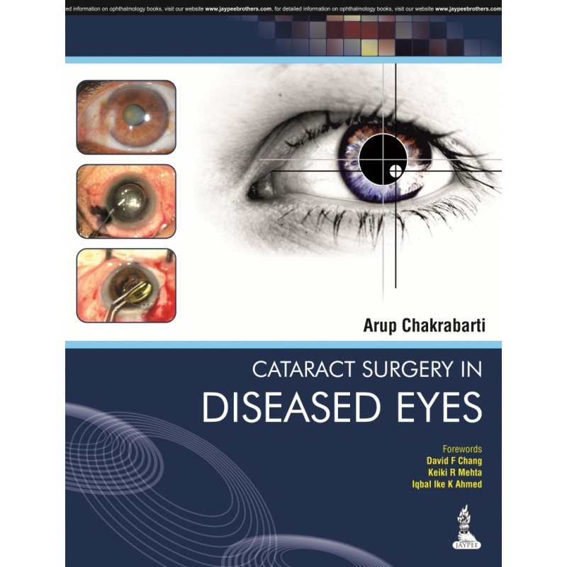 Cataract Surgery in Diseased Eyes